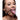 Close-up of a woman with a Claw Hook Mouth Spreader in her mouth against a white background
